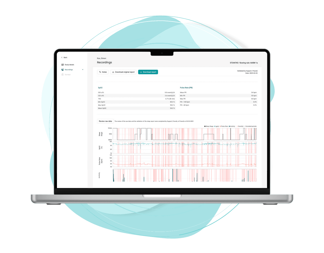 TipTraQ recording view with SpO₂, pulse rate and sleep-stage traces